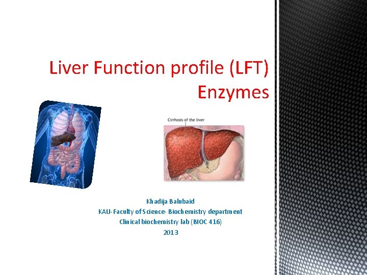Liver Function profile (LFT) Enzymes Khadija Balubaid KAU-Faculty of Science- Biochemistry department Clinical biochemistry