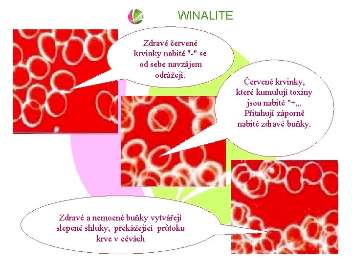 WINALITE Zdravé červené krvinky nabité "-" se od sebe navzájem odrážejí. Zdravé a nemocné