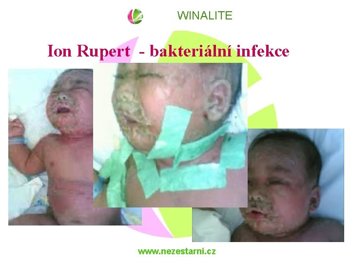 WINALITE Ion Rupert - bakteriální infekce www. nezestarni. cz 