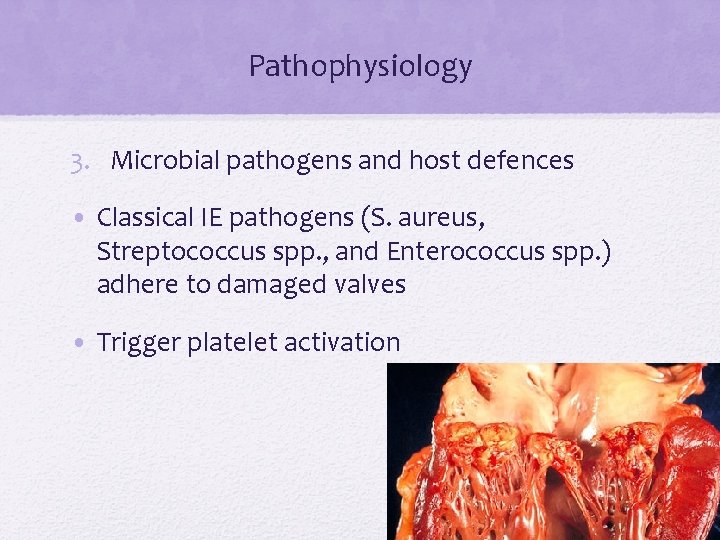 Pathophysiology 3. Microbial pathogens and host defences • Classical IE pathogens (S. aureus, Streptococcus Pathophysiology 3. Microbial pathogens and host defences • Classical IE pathogens (S. aureus, Streptococcus