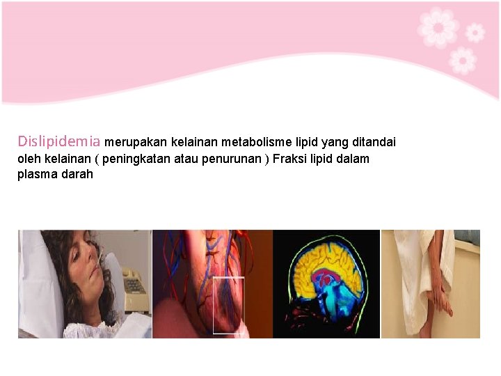 Dislipidemia merupakan kelainan metabolisme lipid yang ditandai oleh kelainan ( peningkatan atau penurunan )