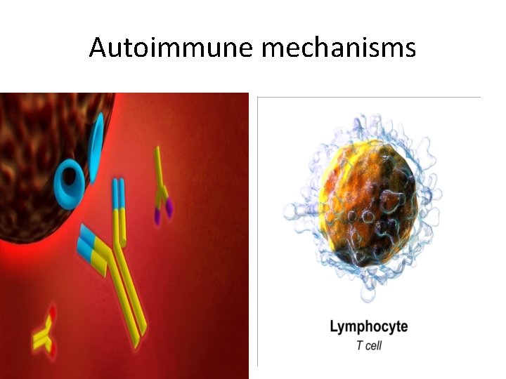 Autoimmune mechanisms 