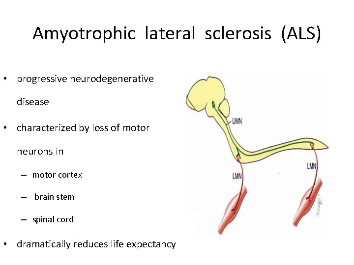 Amyotrophic lateral sclerosis (ALS) • progressive neurodegenerative disease • characterized by loss of motor