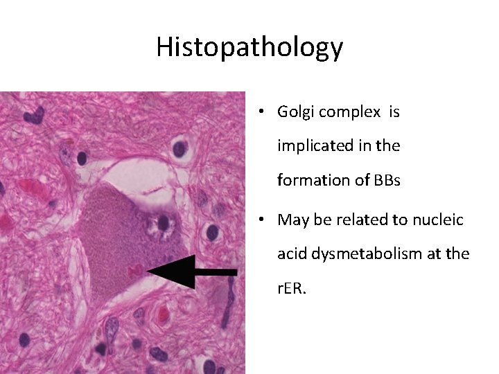 Histopathology • Golgi complex is implicated in the formation of BBs • May be