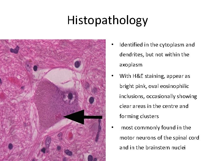 Histopathology • Identified in the cytoplasm and dendrites, but not within the axoplasm •