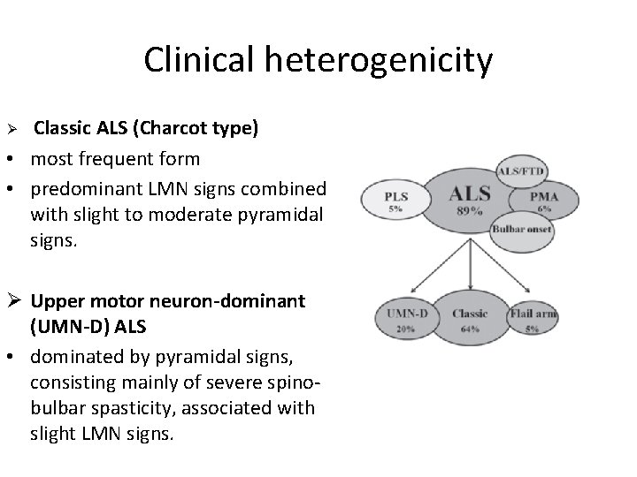 Clinical heterogenicity Classic ALS (Charcot type) • most frequent form • predominant LMN signs