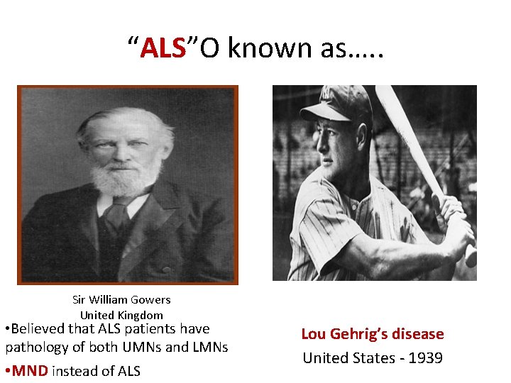 “ALS”O known as…. . Sir William Gowers United Kingdom • Believed that ALS patients