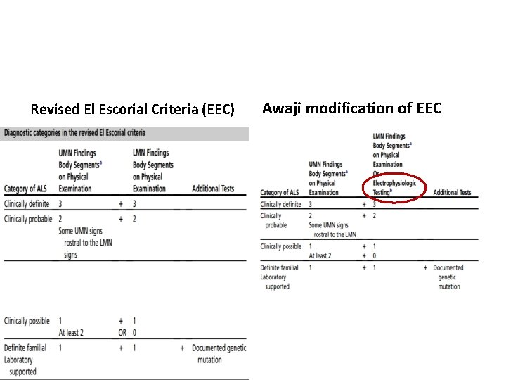 Revised El Escorial Criteria (EEC) Awaji modification of EEC 