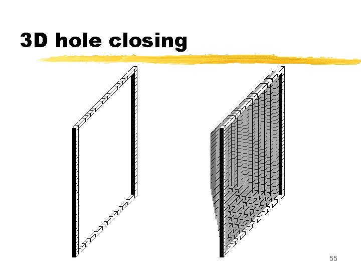 3 D hole closing 55 