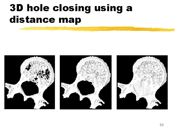 3 D hole closing using a distance map 59 