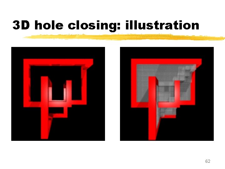 3 D hole closing: illustration 62 