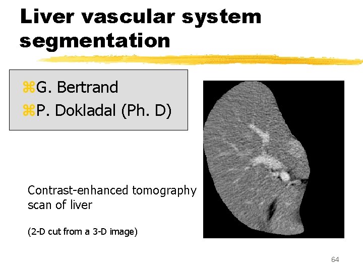 Liver vascular system segmentation z. G. Bertrand z. P. Dokladal (Ph. D) Contrast-enhanced tomography