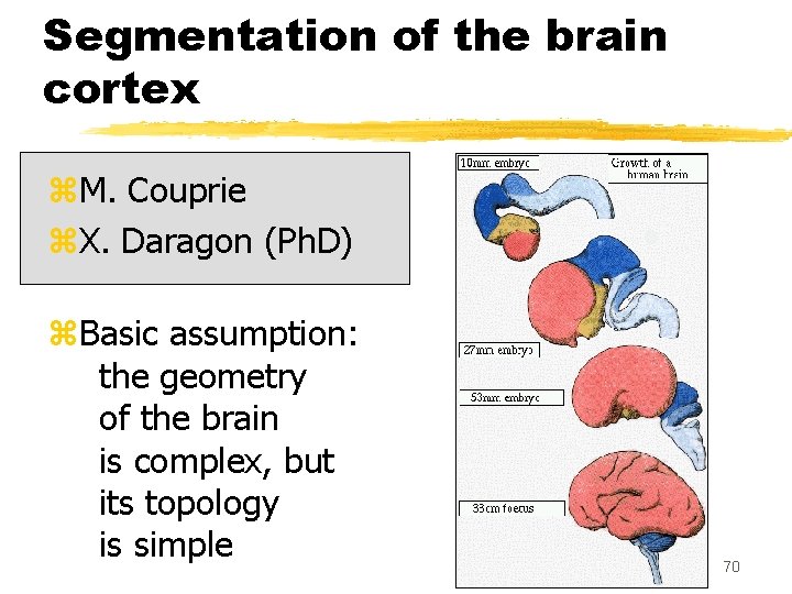 Segmentation of the brain cortex z. M. Couprie z. X. Daragon (Ph. D) z.