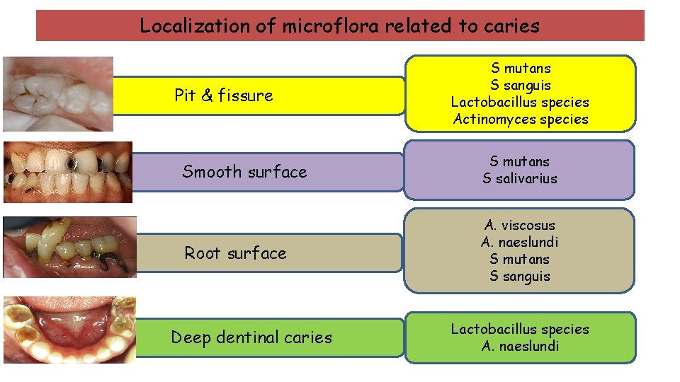 Localization of microflora related to caries Pit & fissure S mutans S sanguis Lactobacillus