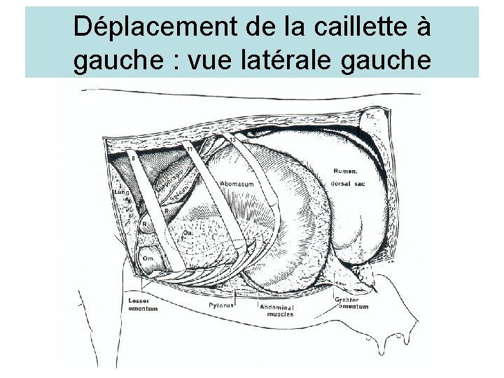Déplacement de la caillette à gauche : vue latérale gauche 