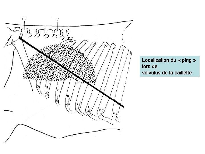 Localisation du « ping » lors de volvulus de la caillette 