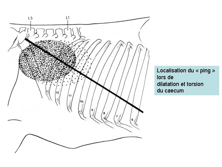 Localisation du « ping » lors de dilatation et torsion du caecum 