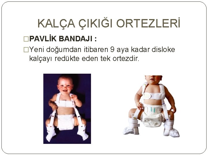 KALÇA ÇIKIĞI ORTEZLERİ �PAVLİK BANDAJI : �Yeni doğumdan itibaren 9 aya kadar disloke kalçayı