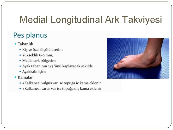 Medial Longitudinal Ark Takviyesi 