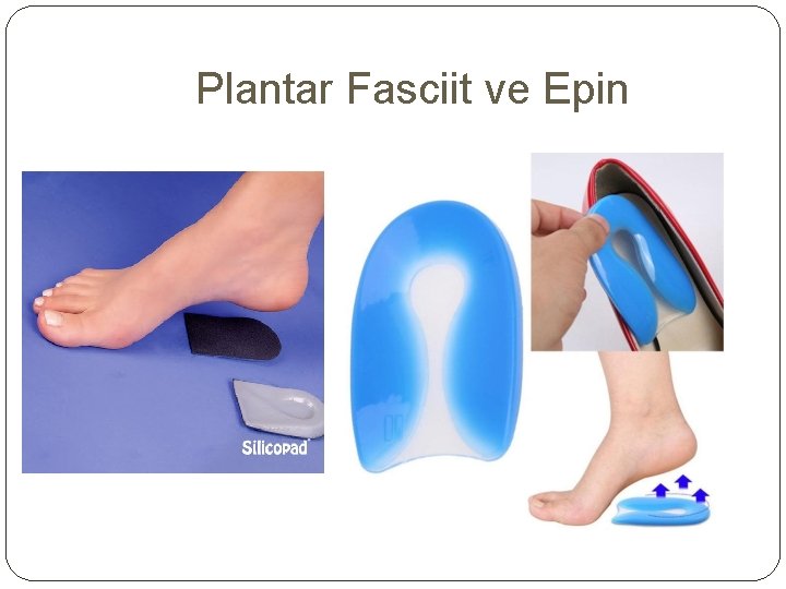 Plantar Fasciit ve Epin 