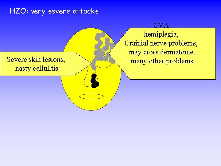 HZO: very severe attacks Severe skin lesions, nasty cellulitis CVA hemiplegia, Crainial nerve problems,