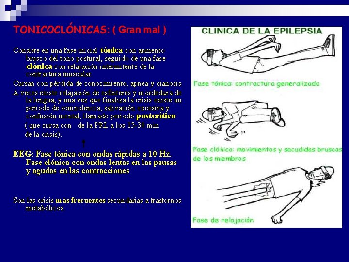 TONICOCLÓNICAS: ( Gran mal ) Consiste en una fase inicial tónica con aumento brusco TONICOCLÓNICAS: ( Gran mal ) Consiste en una fase inicial tónica con aumento brusco