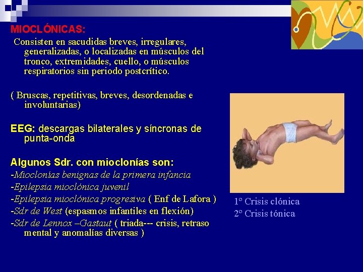 MIOCLÓNICAS: Consisten en sacudidas breves, irregulares, generalizadas, o localizadas en músculos del tronco, extremidades, MIOCLÓNICAS: Consisten en sacudidas breves, irregulares, generalizadas, o localizadas en músculos del tronco, extremidades,