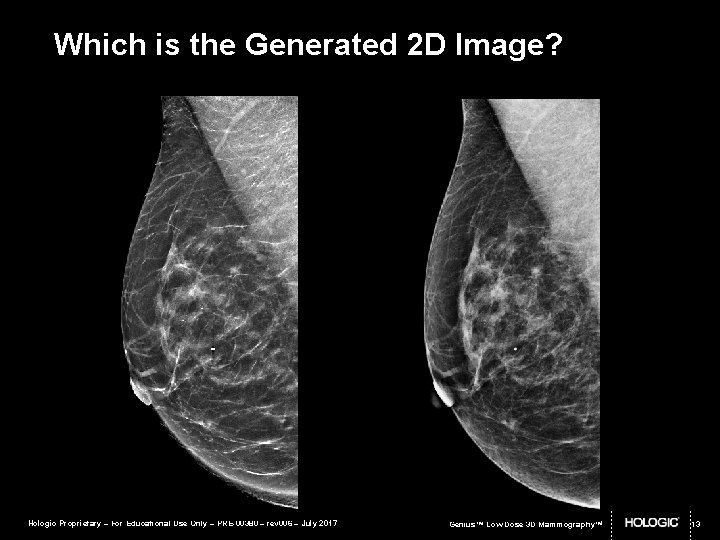 Which is the Generated 2 D Image? Hologic Proprietary – For Educational Use Only