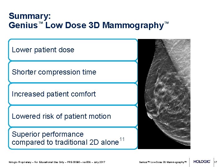 Summary: Genius™ Low Dose 3 D Mammography™ Lower patient dose Shorter compression time Increased