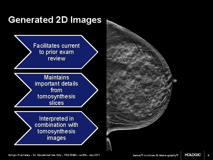 Generated 2 D Images Facilitates current to prior exam review Maintains important details from