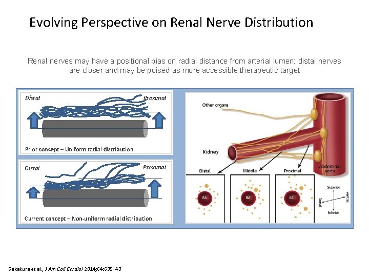 Evolving Perspective on Renal Nerve Distribution Renal nerves may have a positional bias on