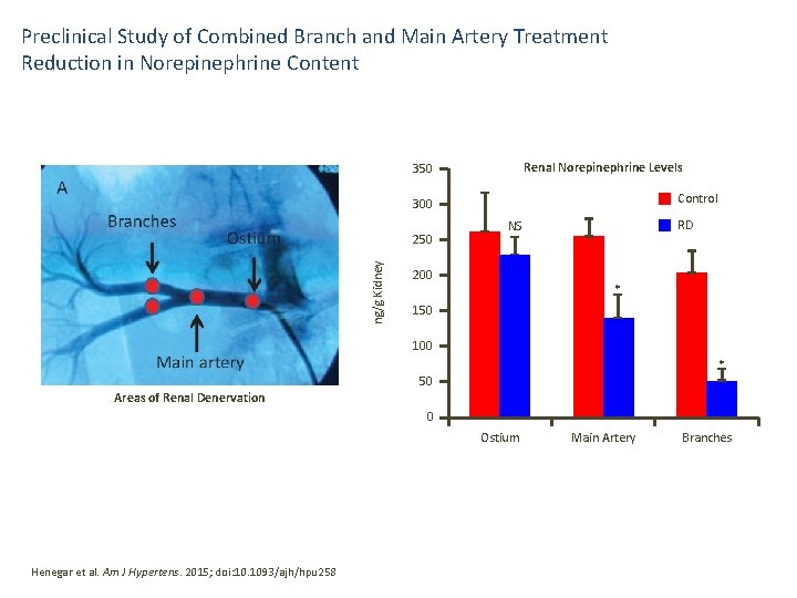 Preclinical Study of Combined Branch and Main Artery Treatment Reduction in Norepinephrine Content Renal