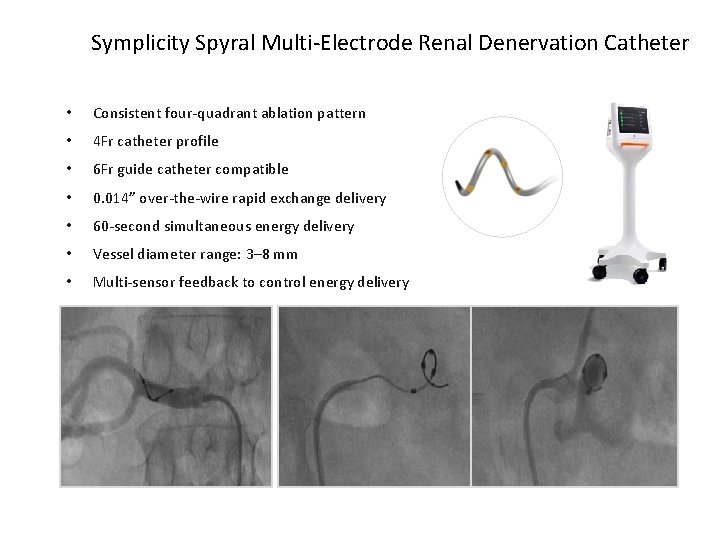 Symplicity Spyral Multi-Electrode Renal Denervation Catheter • Consistent four-quadrant ablation pattern • 4 Fr