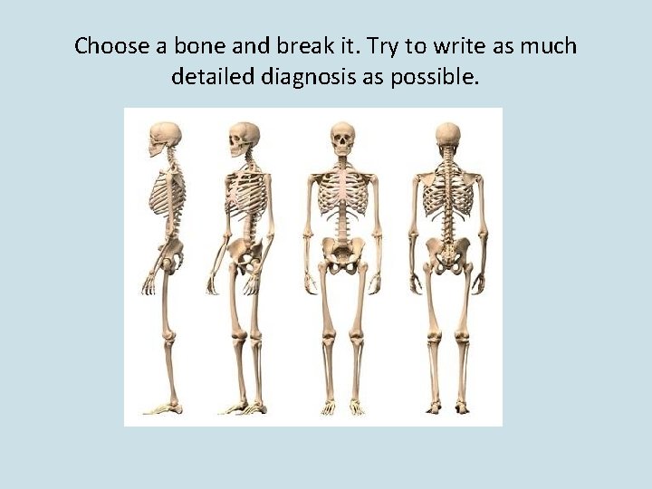 Choose a bone and break it. Try to write as much detailed diagnosis as