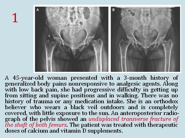 1 A 45 -year-old woman presented with a 3 -month history of generalized body