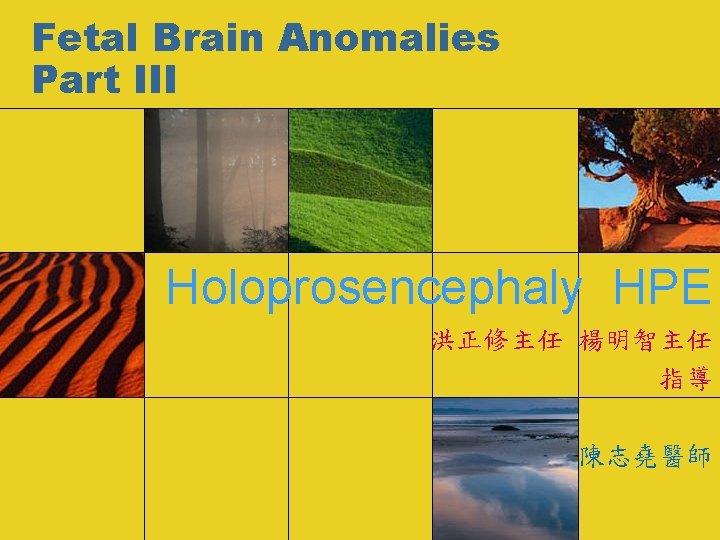 Fetal Brain Anomalies Part III Holoprosencephaly HPE 洪正修主任 楊明智主任 指導 陳志堯醫師 
