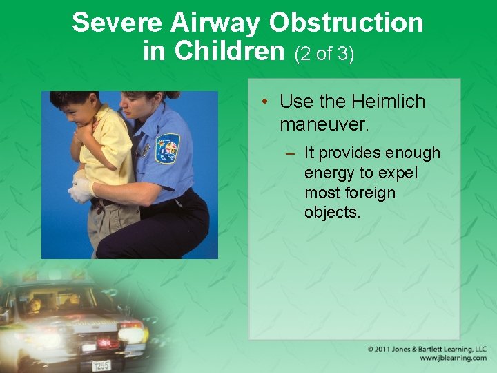 Severe Airway Obstruction in Children (2 of 3) • Use the Heimlich maneuver. –