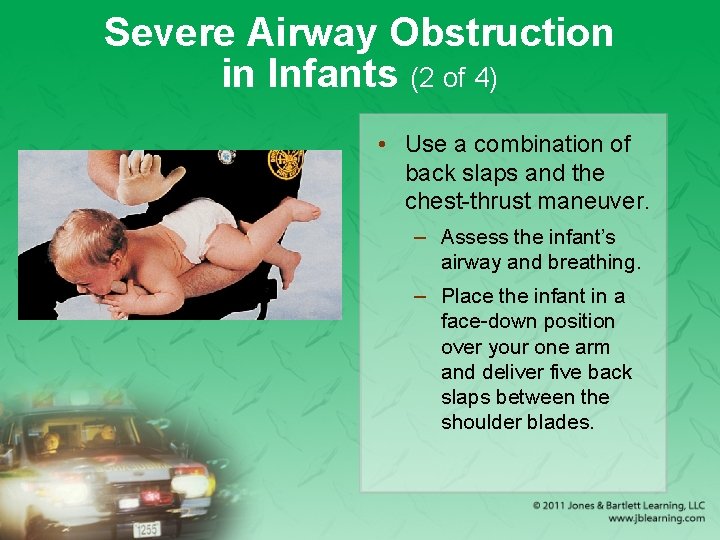 Severe Airway Obstruction in Infants (2 of 4) • Use a combination of back