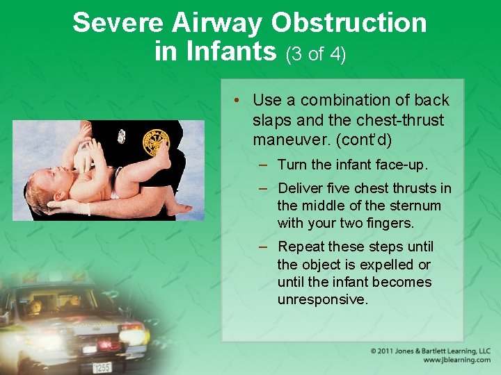 Severe Airway Obstruction in Infants (3 of 4) • Use a combination of back