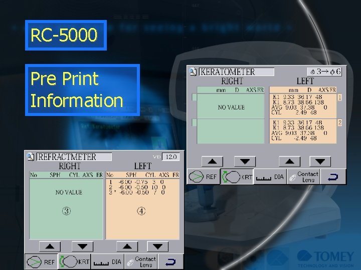 RC-5000 Pre Print Information 