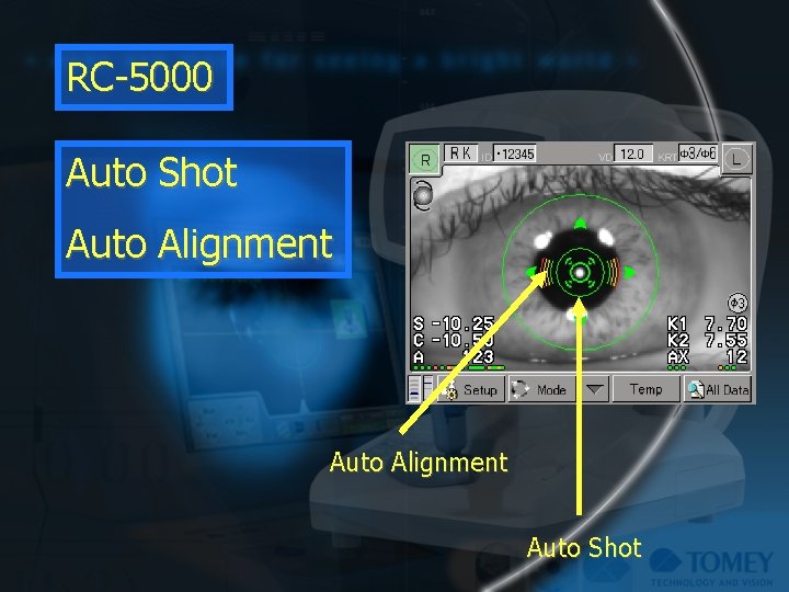 RC-5000 Auto Shot Auto Alignment Auto Shot 