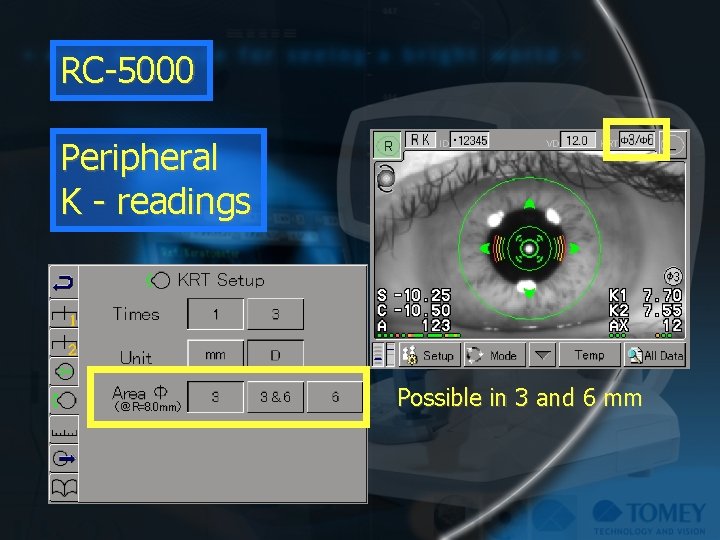 RC-5000 Peripheral K - readings Possible in 3 and 6 mm 