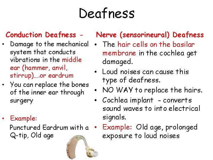 Deafness Conduction Deafness - Nerve (sensorineural) Deafness • Damage to the mechanical • The