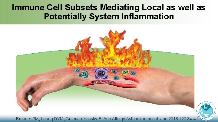 Immune Cell Subsets Mediating Local as well as Potentially System Inflammation Brunner PM, Leung