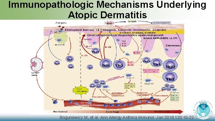 Immunopathologic Mechanisms Underlying Atopic Dermatitis Boguniewicz M, et al. Ann Allergy Asthma Immunol. Jan