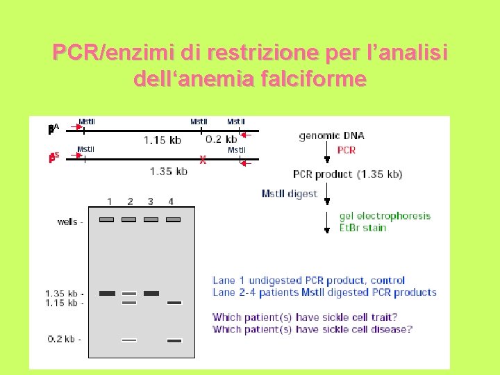 PCR/enzimi di restrizione per l’analisi dell‘anemia falciforme 