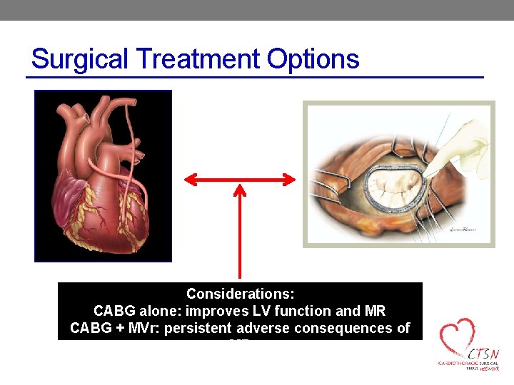 Surgical Treatment Options Considerations: CABG alone: improves LV function and MR CABG + MVr: