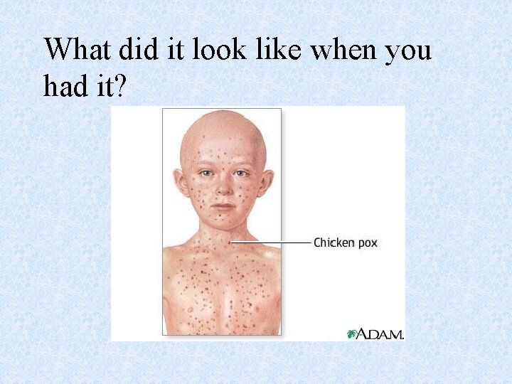 What did it look like when you had it? 