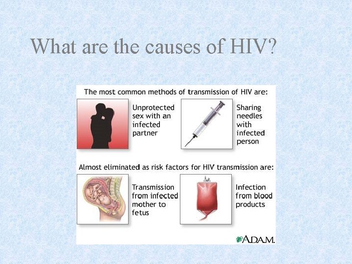 What are the causes of HIV? 