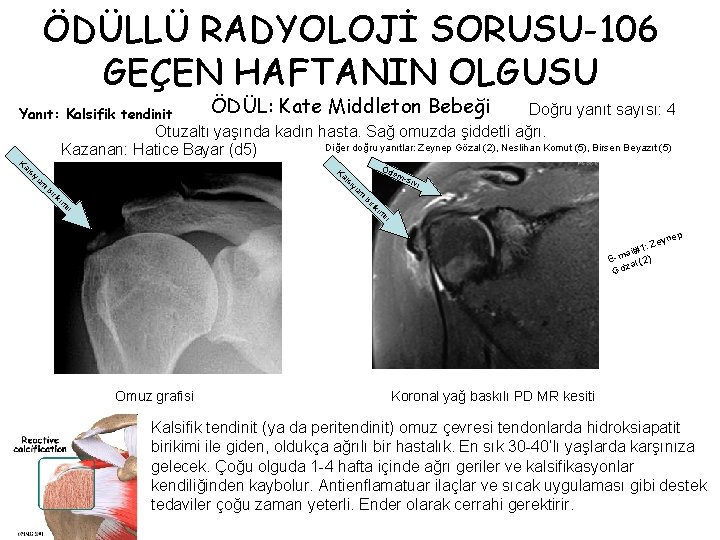 ÖDÜLLÜ RADYOLOJİ SORUSU-106 GEÇEN HAFTANIN OLGUSU Ka ÖDÜL: Kate Middleton Bebeği Doğru yanıt sayısı: